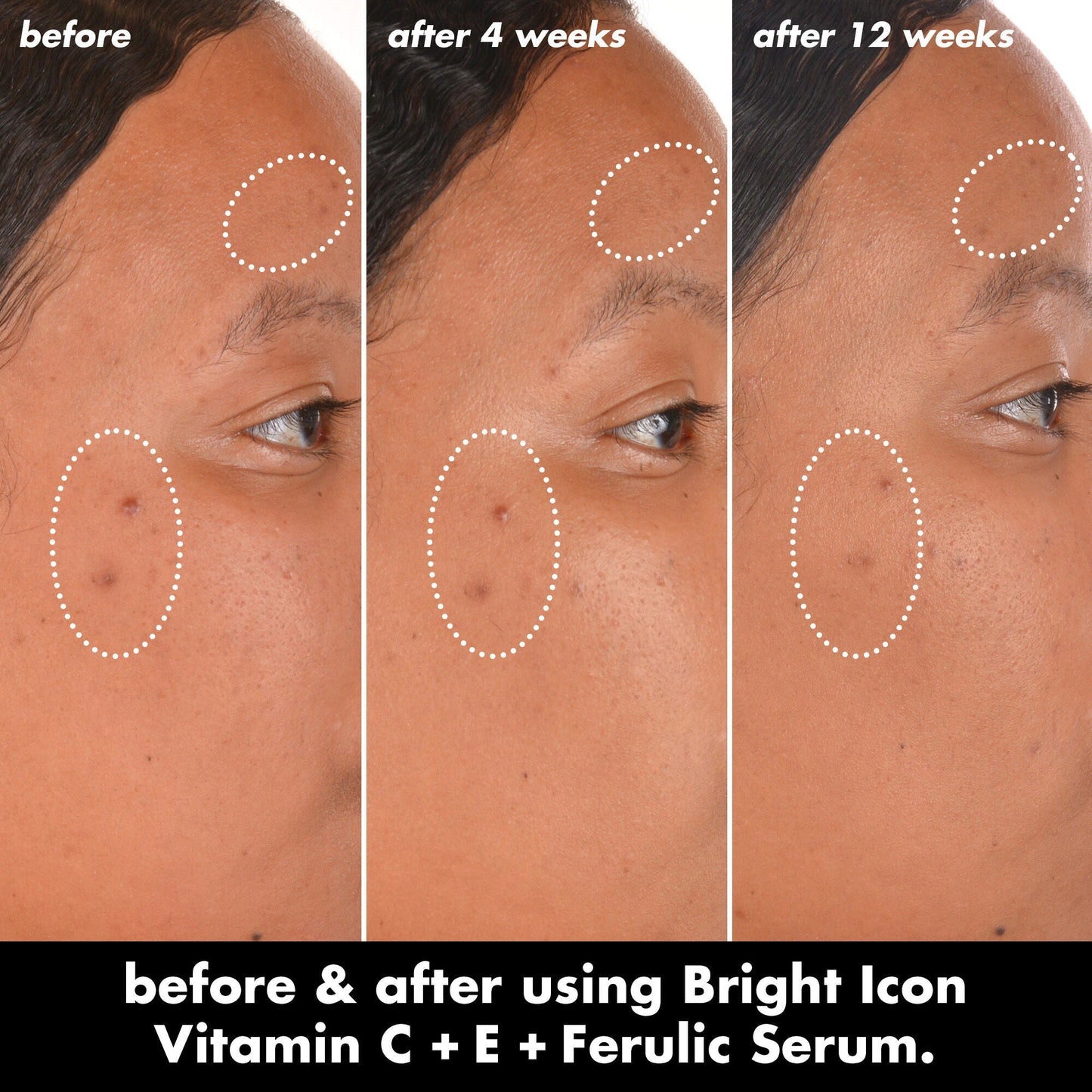 bright-icon-vitamin-c-e-ferulic-serum-z2 0226_EDU_BrightIconVitC_BA_Chanel_TRIPTYCH_c58f2fc8-209d-414f-9ba3-666a07a94887.jpg