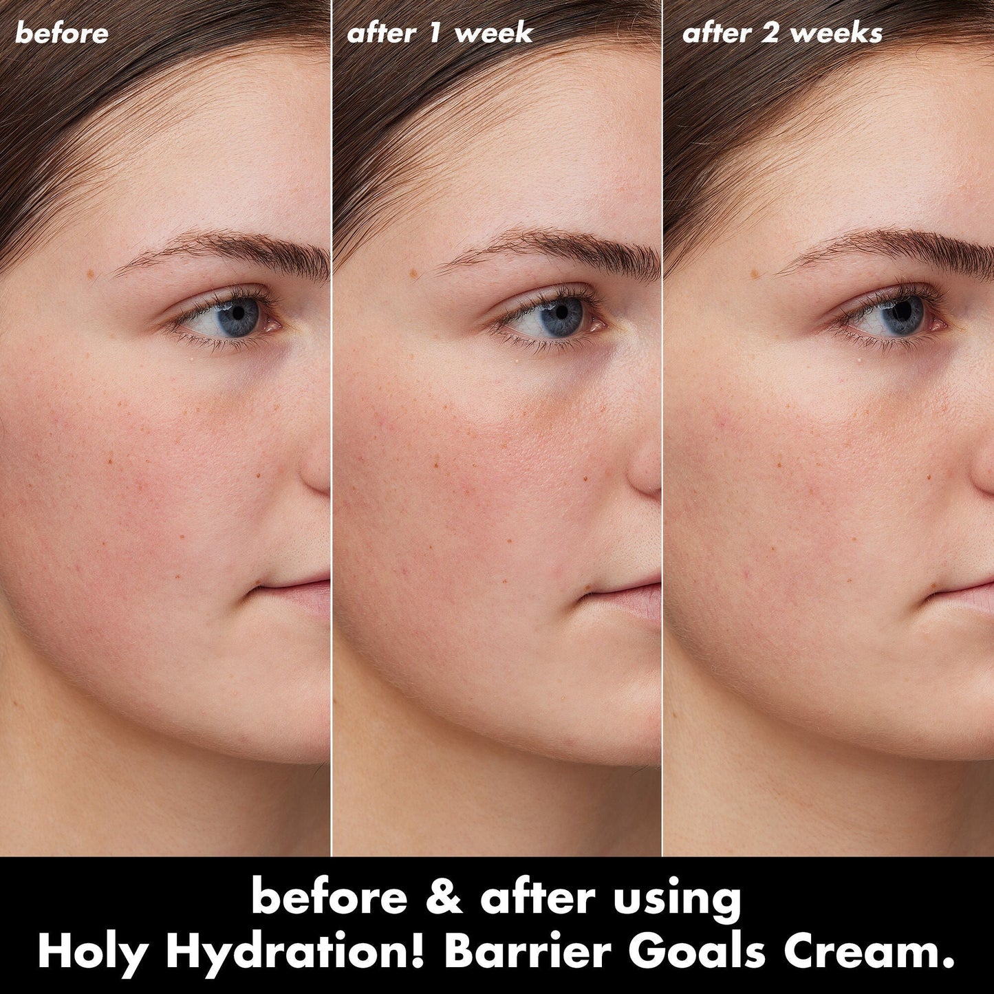 holy-hydration-barrier-goals-cream-mini-y5 0226_EDU_HHBarrierGoalsCream_B_A_Zoe_TRYPTICH_4f0e5b5d-35fb-4020-968e-244d4536afbd.jpg