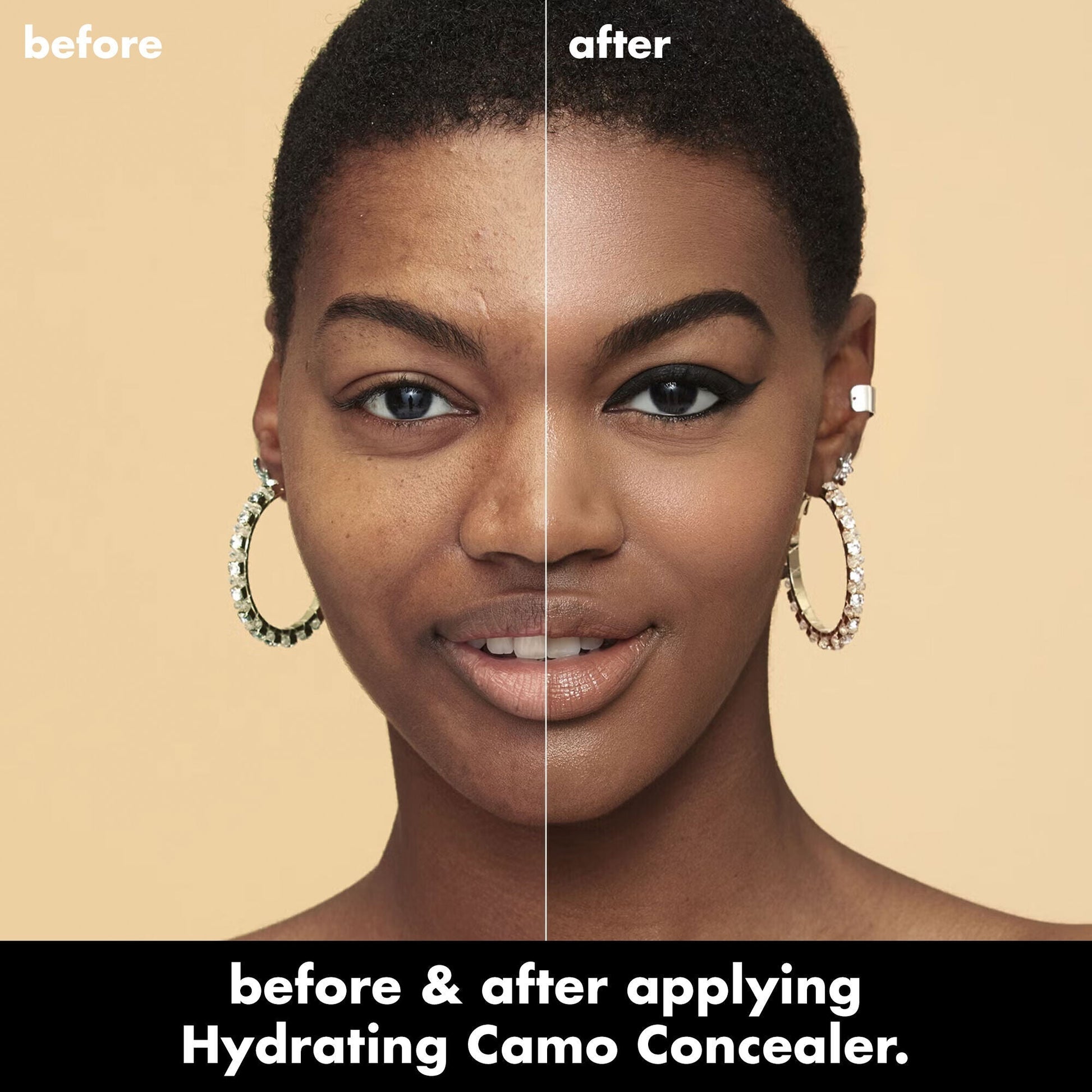 hydrating-camo-concealer-u7 0226_EDU_HydratingCamoConcelaer_BA_AshleyKaresh_20_1_d8499bbf-0e91-4173-b5e2-75127caf83a3.jpg