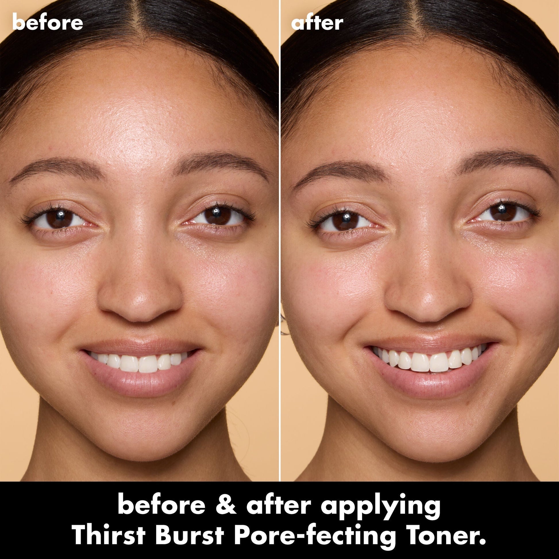 thirst-burst-pore-fecting-toner-v6 0326_EDU_THIRSTBURSTTONER_BA_Model2_74314ff2-51ab-45b4-905d-568569dd1359.jpg