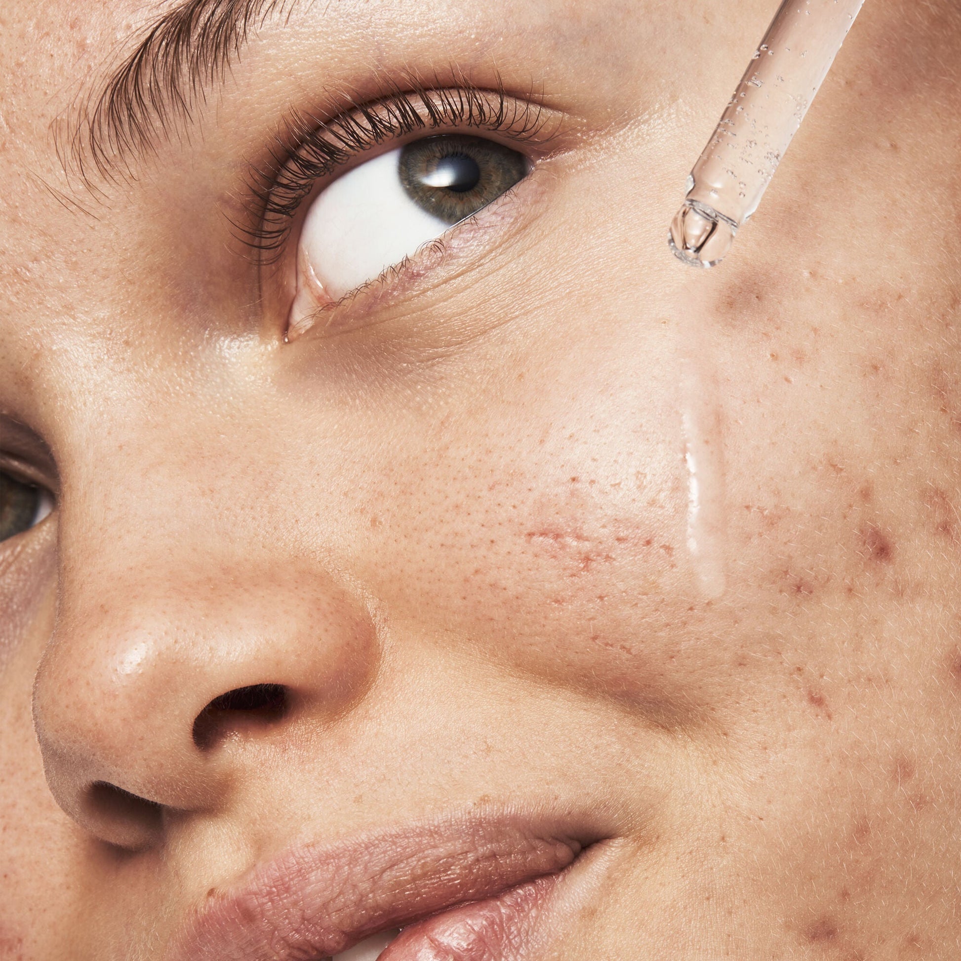 blemish-breakthrough-triple-acid-resurfacing-serum-d5 121321_Marley-Acne-Regimen_0254_FINAL_IGF.jpg