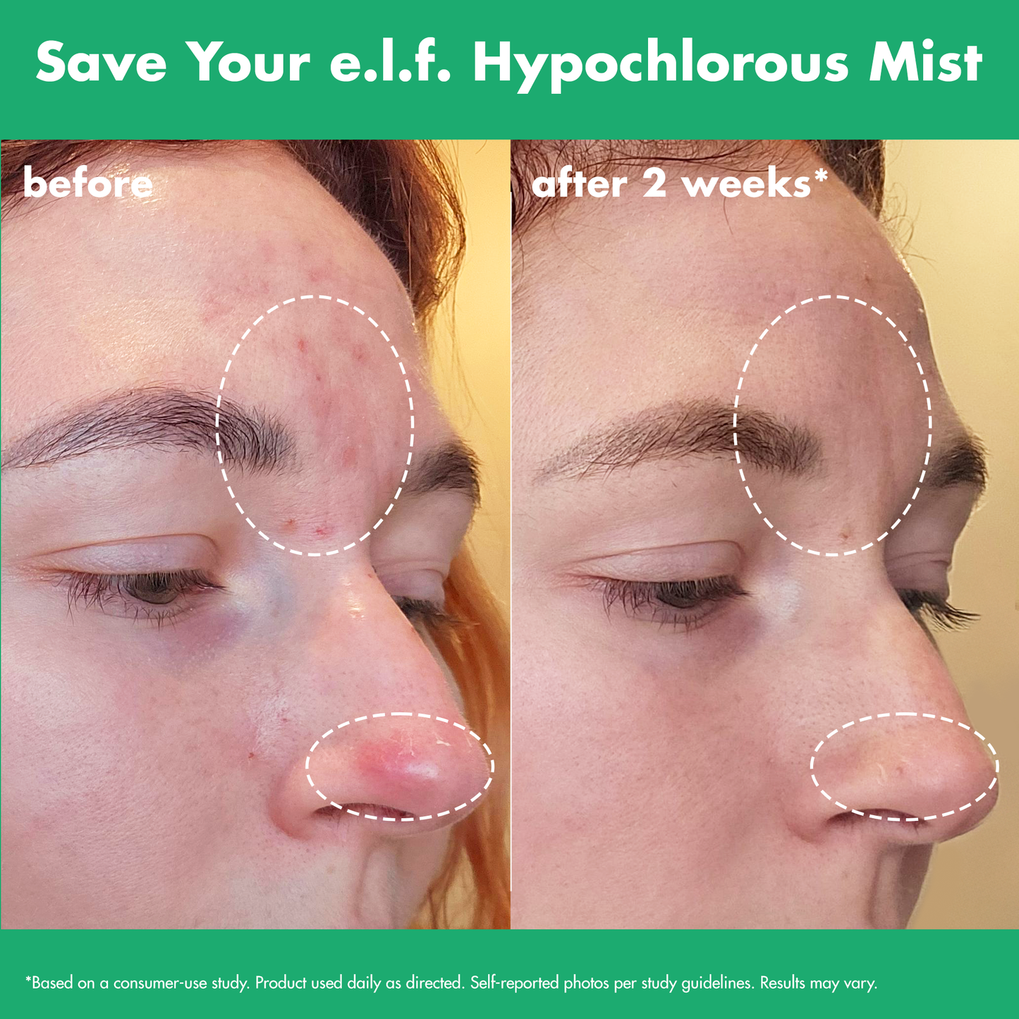 save-your-e-l-f-hypochlorous-mist-l8 FA26_EDUCATION_SAVEYOURELF_USAGE_BA1_WITHOUT_CLAIMS.png