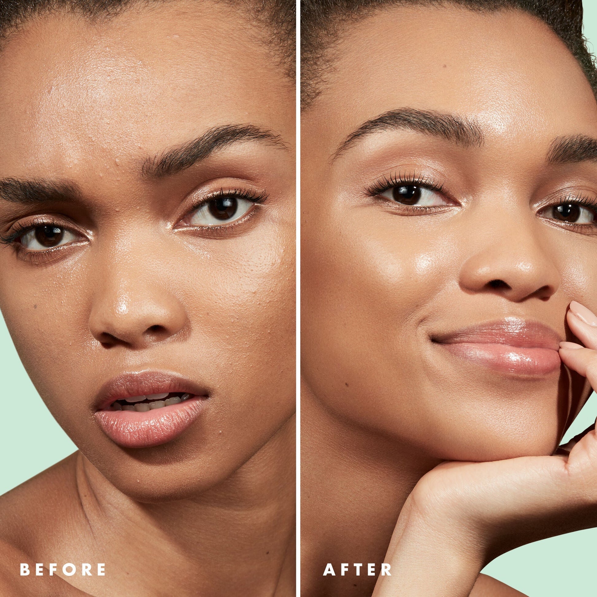 blemish-control-face-primer-large-size-v7 Primer_PP_Before_After_BlemishControl_2000x2000_3774231e-d4e1-49dd-b3d7-a73cbac901fe.jpg